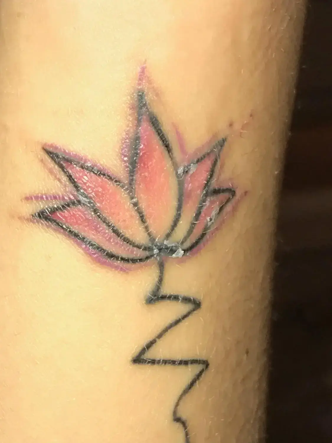 Tattoo Lines Thicker After Healing