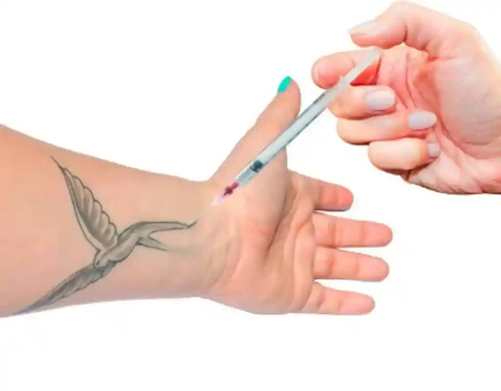 Why-Do-They-Ask-If-You-Have-Tattoos-Before-Surgery