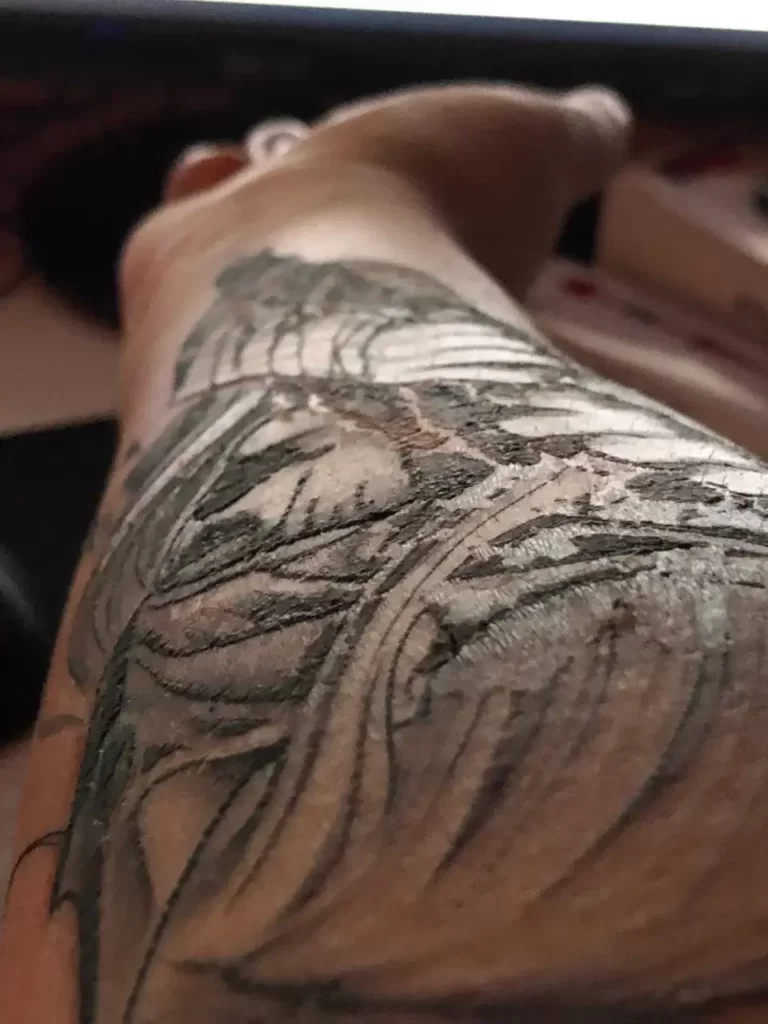 Tattoo Losing Ink While Healing