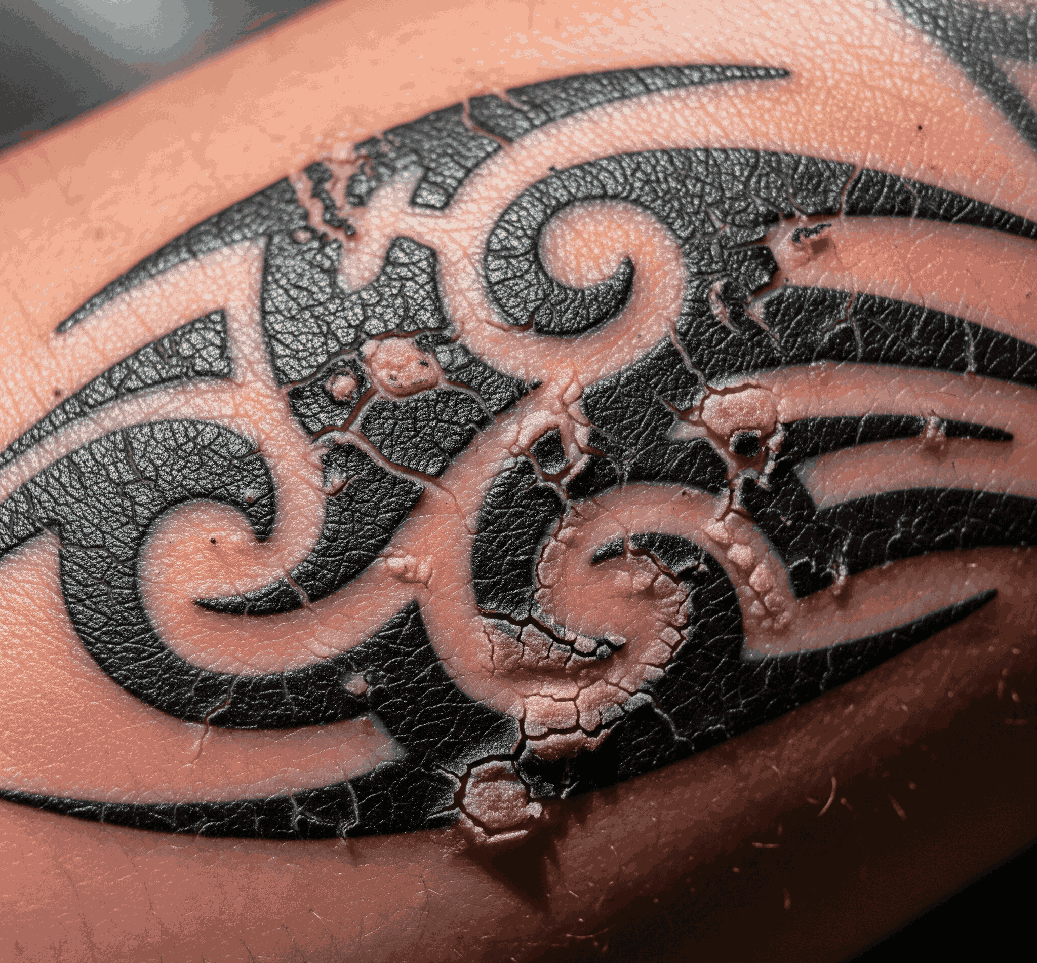 tattoo bubbling