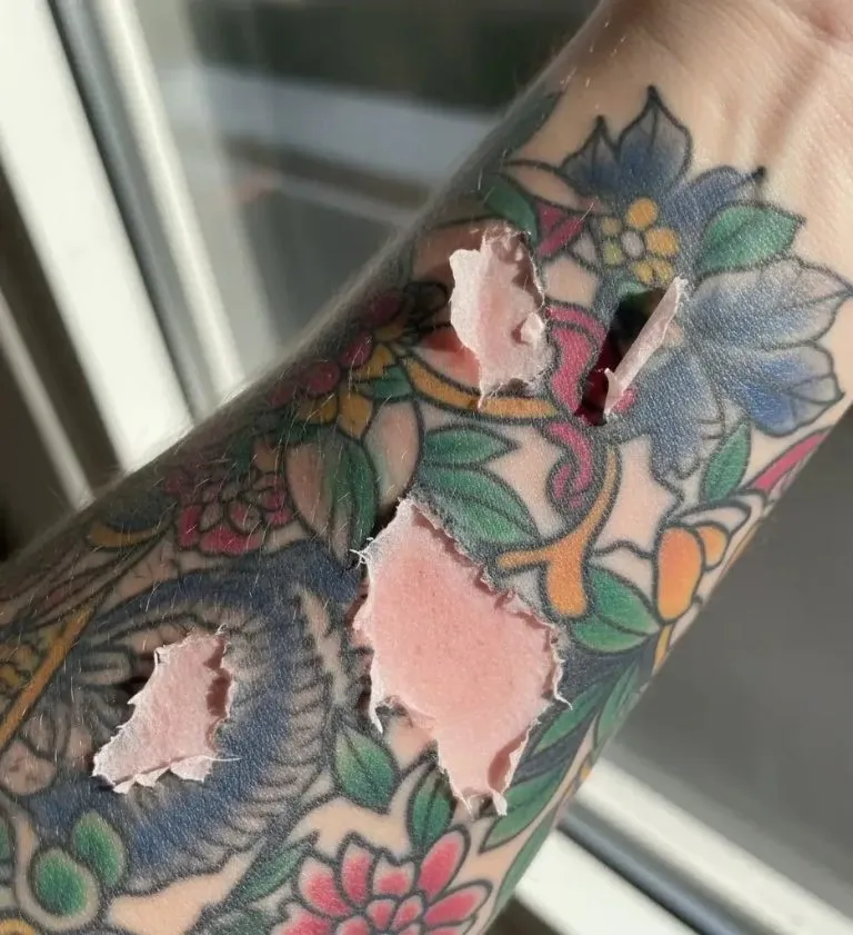 Chunks of skin missing from a tattoo