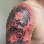 will cellulitis ruin the tattoo