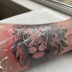 Tattoo Burns After Lotion