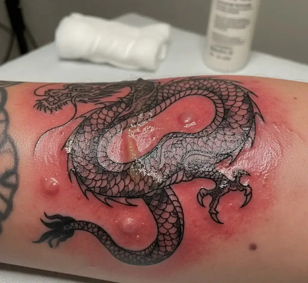 Why Is It Risky to Tattoo on Irritated or Swollen Skin?