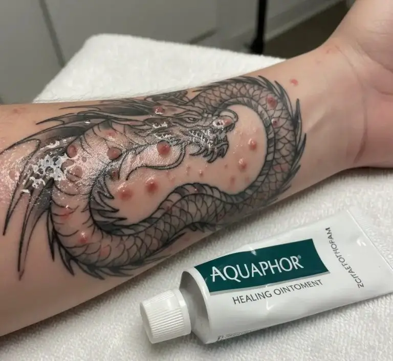 Does Aquaphor Cause Pimples On New Tattoo