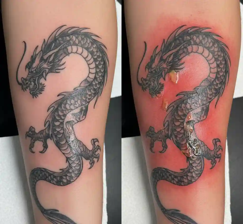 How Do I Know If My Tattoo Is Infected